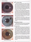 Practical Iridology by Steven Horne